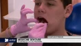 Détartrage de la médecine dentaire scolaire fribourgeoise