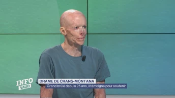 Grand brûlé depuis 25 ans, il témoigne pour soutenir