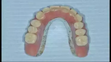 Diagnostic du 24.04.12 - Les implants dentaires pour les personnes âgées 2/4