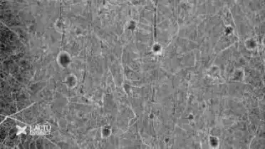 EPFL : des millions pour la recherch sur le cerveau