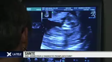Quel avenir pour le diagnostic préimplantatoire ?