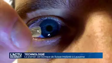 Le premier oeil bionique de Suisse implanté à Lausanne