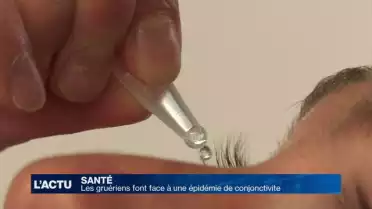 Les Gruériens font face à une épidémie de conjonctivite