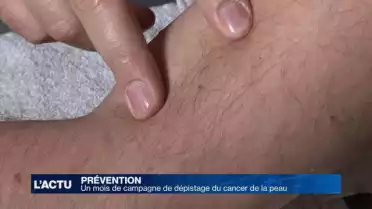 Un mois de campagne de dépistage du cancer de la peau