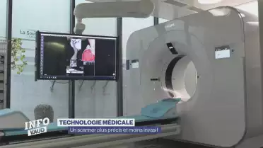 Un scanner moins invasif et plus précis