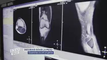 Quand les os ont un genre