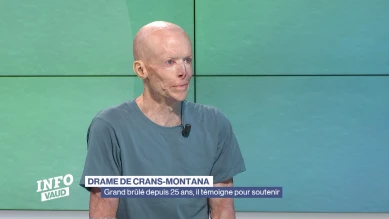 Grand brûlé depuis 25 ans, il témoigne pour soutenir