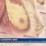 Cancer du sein: en parler pour mieux prévenir