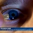 Le premier oeil bionique de Suisse implanté à Lausanne