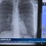 Un moratoire sur les équipements médicaux lourds à Fribourg