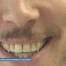Une moustache pour la bonne cause