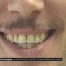 Movember ou la moustache contre les maladies masculines