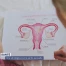Le canton développe une stratégie de santé sexuelle