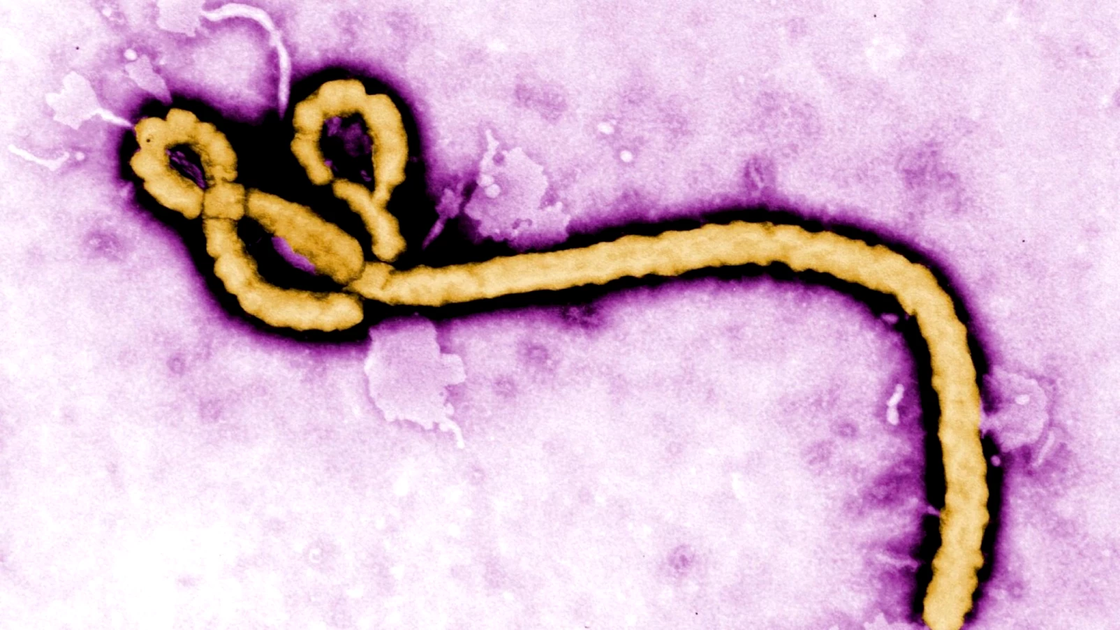 OMS déclare urgence de santé publique pour Ebola en RDC et Ouganda
