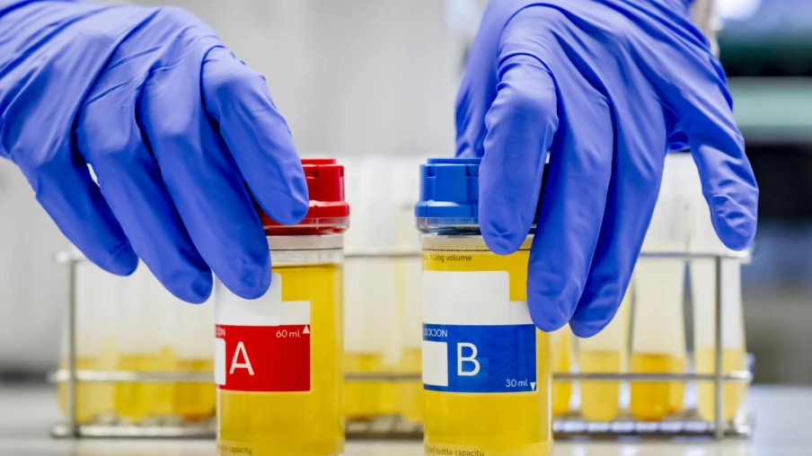 LAD d'Épalinges: comment le laboratoire analyse 20'000 échantillons