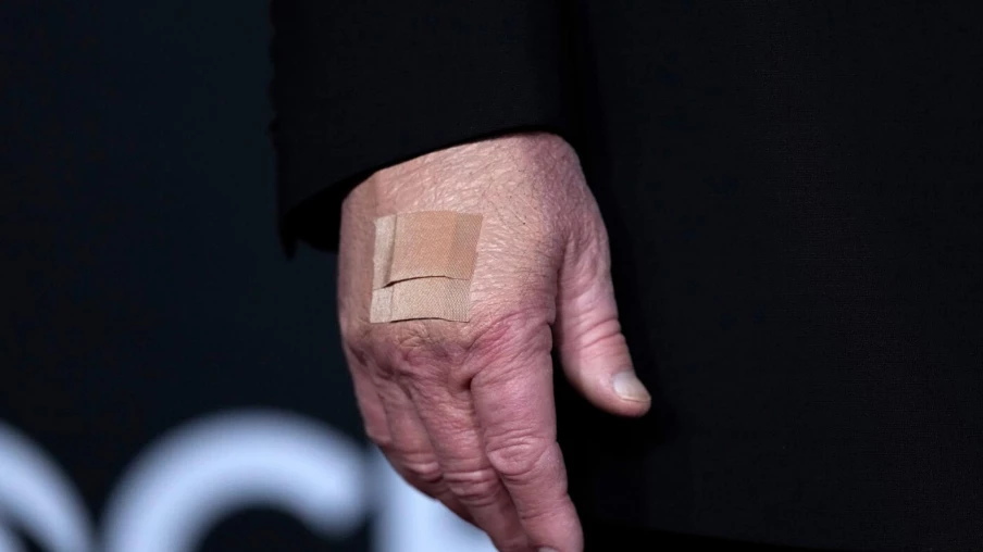 Trump arbore à nouveau un pansement: poignées de main pointées