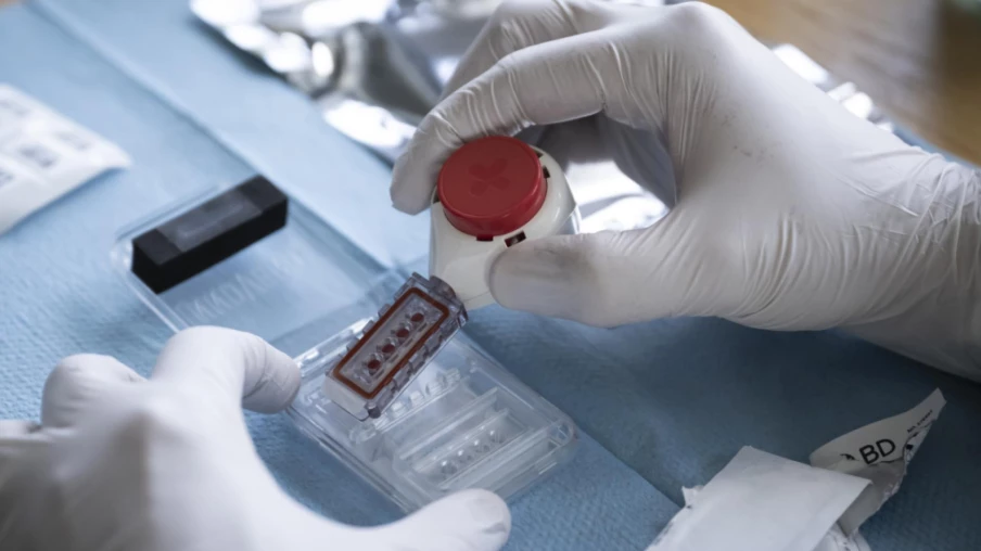 85 colis dopants saisis en ligne: lien avec le sport suisse?