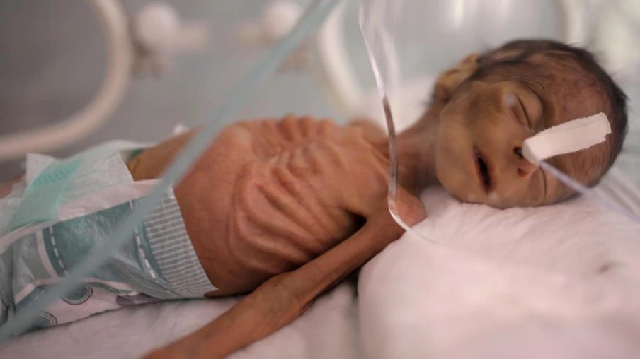 Mortalité infantile: 4,9 millions d'enfants en 2024, l'ONU s'inquiète