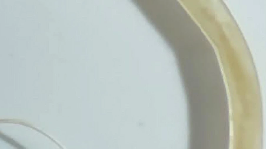 Découverte d'une nouvelle espèce de ver parasite exposée au musée de Bâle